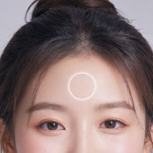 이마주름 개선 부위 이미지