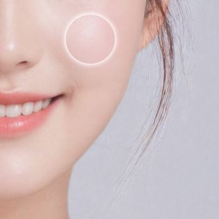 볼꺼짐 개선 부위 이미지