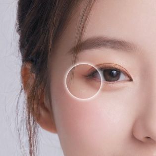 눈가 주름 개선 부위 이미지