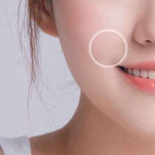 팔자 주름 개선 부위 이미지