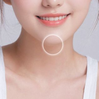 이중턱 처짐 개선 부위 이미지