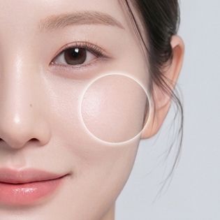 광대 주름 개선 부위 이미지