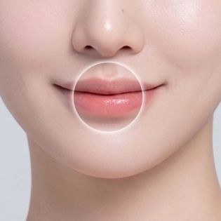 입술 라인 개선 부위 이미지