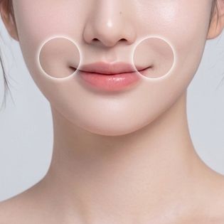 팔자 주름 개선 부위 이미지