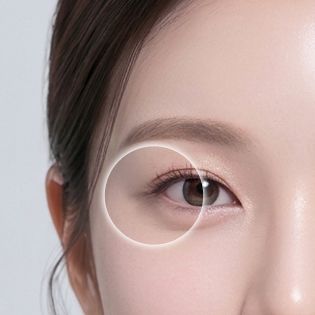 눈가 및 인디언 주름 개선 부위 이미지
