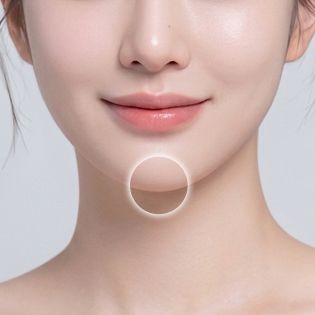 이중턱 및 V라인 개선 부위 이미지