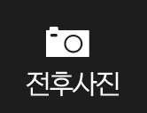 전후사진
