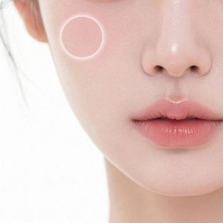 광대주름 개선 부위 이미지