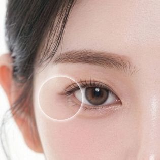눈가 및 인디언 주름 개선 부위 이미지