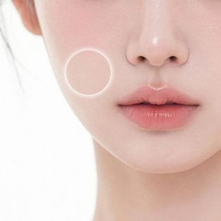 볼살 처짐 개선 부위 이미지