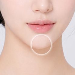 턱 개선 부위 이미지