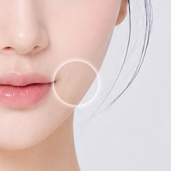 심부볼 개선 부위 이미지