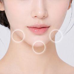 V라인 개선 부위 이미지